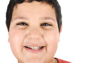 Close-up portrait of a kid with braces