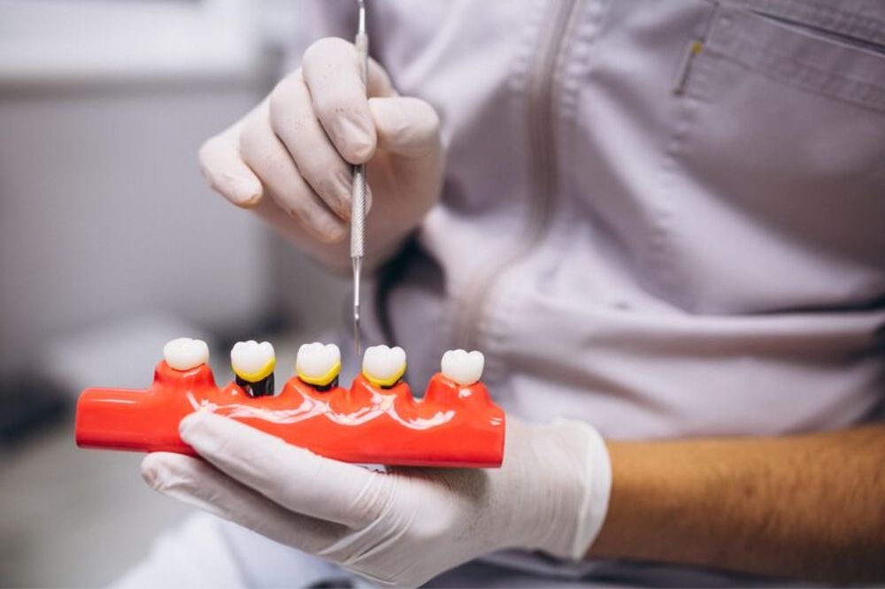 dental bridges in newmarket