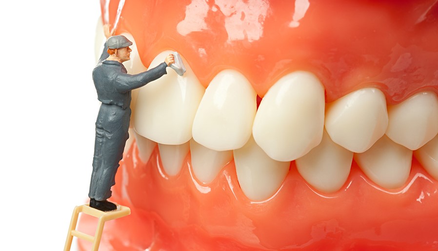 dental-cleaning-newmarket-newmarket-dentist-keep28-dental-clinic