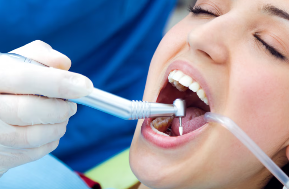 dental sealants near me