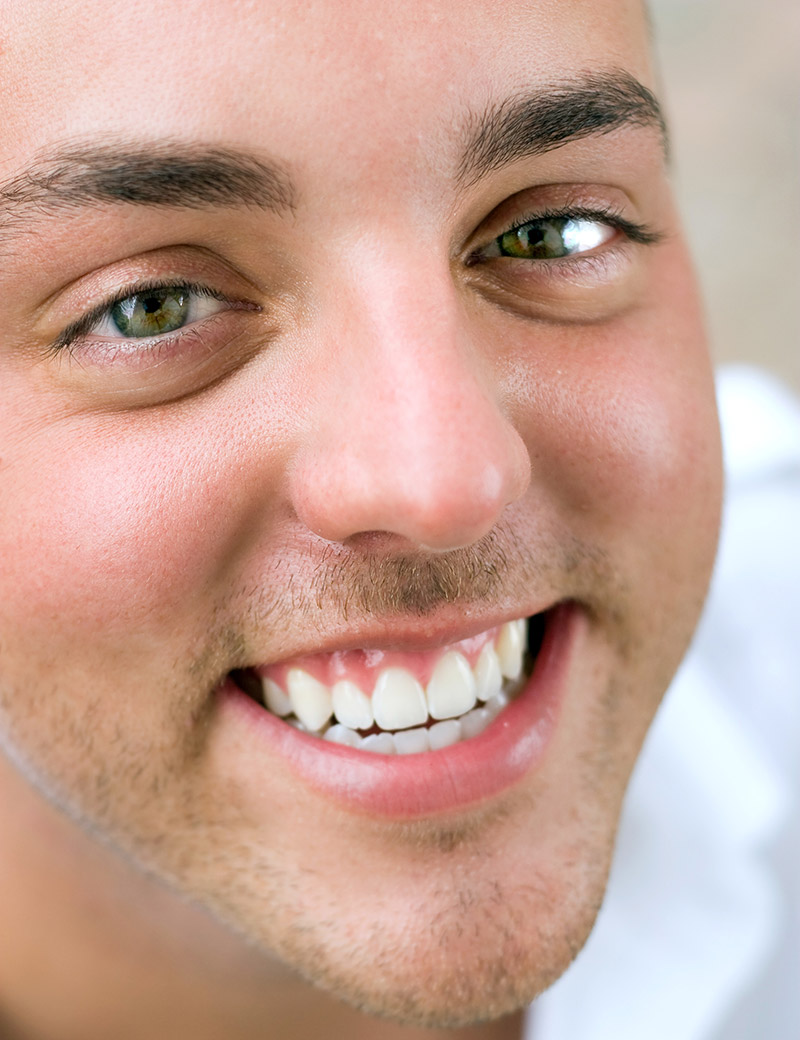 teeth whitening in newmarket