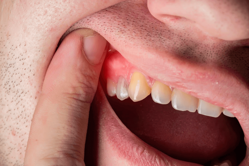 gum diseases near me