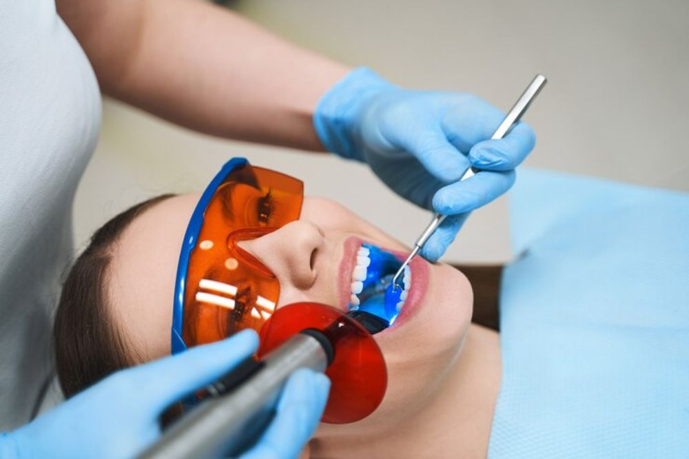 Dental Bonding